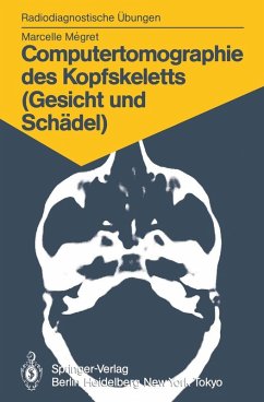 Computertomographie des Kopfskeletts (Gesicht und Schädel) (eBook, PDF) - Megret, Marcelle