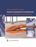 Septische postoperative Komplikationen (eBook, PDF)
