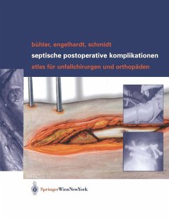 Septische postoperative Komplikationen (eBook, PDF) - Bühler, Matthias; Engelhardt, Martin; Schmidt, Hergo G. K.