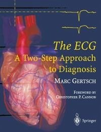 The ECG (eBook, PDF) - Gertsch, Marc