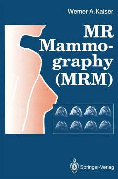 MR Mammography (MRM) (eBook, PDF) - Kaiser, Werner A.