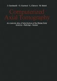 Computerized Axial Tomography (eBook, PDF) Computerized Axial Tomography (eBook, PDF)