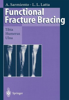 Cover Functional Fracture Bracing (eBook, PDF)