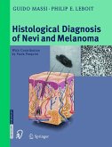 Histological Diagnosis of Nevi and Melanoma (eBook, PDF)