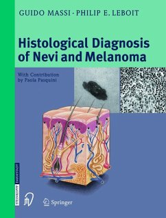 Histological Diagnosis of Nevi and Melanoma (eBook, PDF) - Massi, Guido; Leboit, Philip E.