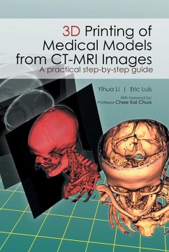 3D Printing of Medical Models from CT-MRI Images - Li Yihua; Eric Luis