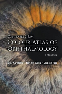 CONSTAB & LIM COLO ATLAS (6TH ED) - Ian J Constable, Tien Yin Wong & Vignesh