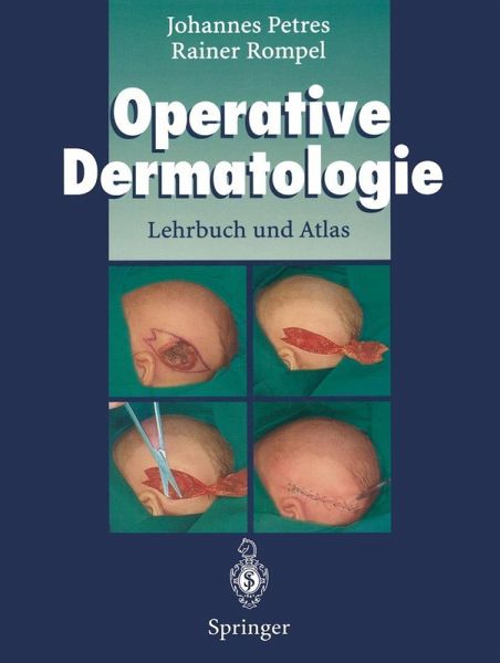 Operative Dermatologie (eBook, PDF) Operative Dermatologie (eBook, PDF)