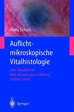 Auflichtmikroskopische Vitalhistologie (eBook, PDF) - Schulz, Hans