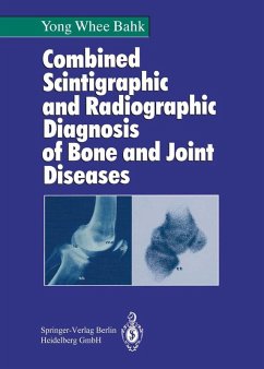 Combined Scintigraphic and Radiographic Diagnosis of Bone and Joint Diseases (eBook, PDF) - Bahk, Yong W.