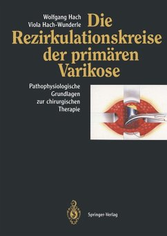 Die Rezirkulationskreise der primären Varikose (eBook, PDF) - Hach, Wolfgang; Hach-Wunderle, Viola