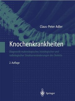 Knochenkrankheiten (eBook, PDF) - Adler, Claus-Peter