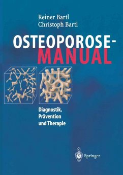 Osteoporose-Manual (eBook, PDF) - Bartl, Reiner; Bartl, Christoph