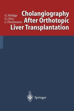 Cholangiography After Orthotopic Liver Transplantation (eBook, PDF) - Nöldge, Gerd; Otto, Gerd; Theilmann, Lorenz