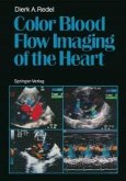 Color Blood Flow Imaging of the Heart (eBook, PDF)