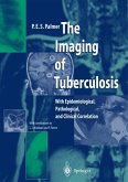 The Imaging of Tuberculosis (eBook, PDF)