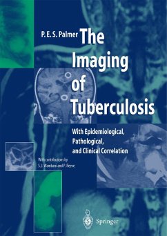 The Imaging of Tuberculosis (eBook, PDF) - Palmer, P. E. S.