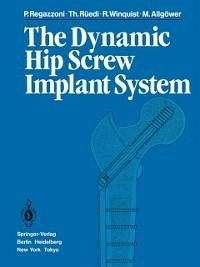 The Dynamic Hip Screw Implant System (eBook, PDF) - Regazzoni, P.; Rüedi, T.; Winquist, R.; Allgöwer, M.