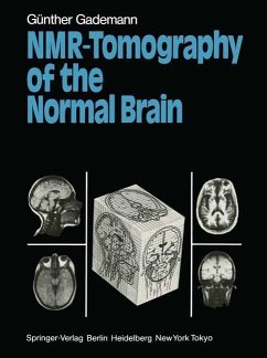 Cover NMR-Tomography of the Normal Brain (eBook, PDF)
