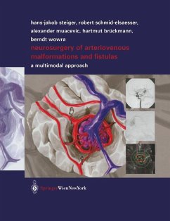 Neurosurgery of Arteriovenous Malformations and Fistulas (eBook, PDF) - Schmid-Elsaesser, Robert; Muacevic, Alexander; Brückmann, Hartmut; Wowra, Berndt