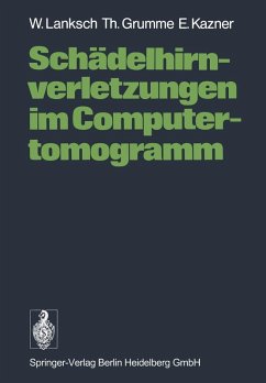 Cover Schädelhirnverletzungen im Computertomogramm (eBook, PDF)