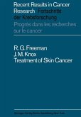 Treatment of Skin Cancer (eBook, PDF)