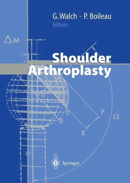 Shoulder Arthroplasty (eBook, PDF) Shoulder Arthroplasty (eBook, PDF)