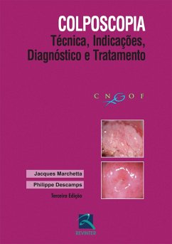 Cover Colposcopia (eBook, ePUB)