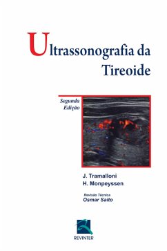 Ultrassonografia da tireoide (eBook, ePUB) - Tramalloni, J.; Monpeyssen, H.