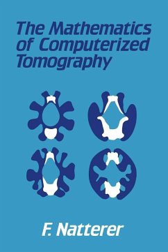 The Mathematics of Computerized Tomography (eBook, PDF) - Natterer, F.