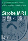 Stroke MRI (eBook, PDF)