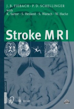 Stroke MRI (eBook, PDF) - Fiebach, Jochen; Schellinger, Peter