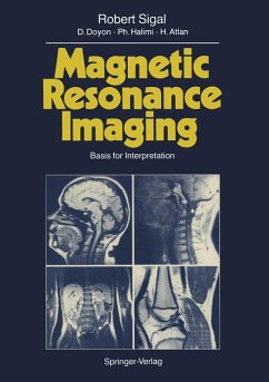 Magnetic Resonance Imaging (eBook, PDF) - Sigal, Robert; Doyon, D.; Halimi, P.; Atlan, H.