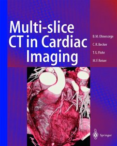 Multi-slice CT in Cardiac Imaging (eBook, PDF) - Ohnesorge, Bernd M.; Flohr, Thomas G.; Becker, Christoph R.; Reiser, Maximilian F