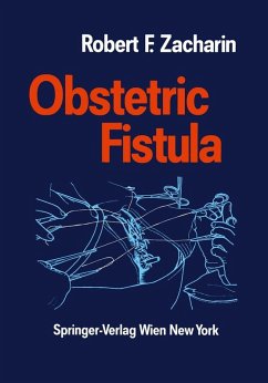 Cover Obstetric Fistula (eBook, PDF)