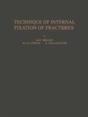 Technique of Internal Fixation of Fractures (eBook, PDF)