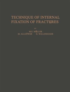 Technique of Internal Fixation of Fractures (eBook, PDF) - Müller, M. E.; Straumann, F.; Weber, B. G.; Bandi, W.; Bloch, H. R.; Allgöwer, M.; Mumenthaler, A.; Willenegger, H.; Schneider, R.; Steinemann, S.