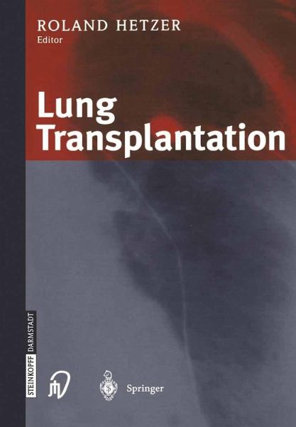 Lung Transplantation (eBook, PDF) Lung Transplantation (eBook, PDF)