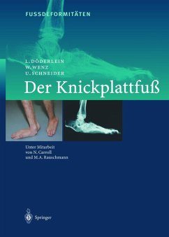 FussdeformitÄten (eBook, PDF) - Döderlein, L.; Wenz, W.; Schneider, U.