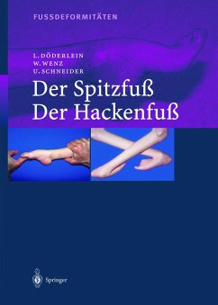 Fussdeformitäten (eBook, PDF) - Döderlein, Leonhard; Wenz, Wolfram; Schneider, Urs