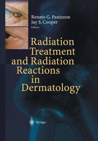 Radiation Treatment and Radiation Reactions in Dermatology (eBook, PDF)