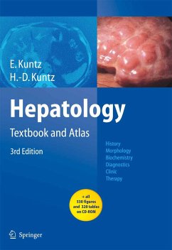Hepatology (eBook, PDF) - Kuntz, Erwin; Kuntz, Hans-Dieter