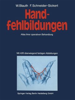 Handfehlbildungen (eBook, PDF) - Blauth, W.; Schneider-Sickert, F.