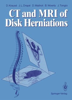CT and MRI of Disk Herniations (eBook, PDF) - Krause, Denis; Drape, Jean L.; Maitrot, Daniel; Woerly, Bernard; Tongio, Jean