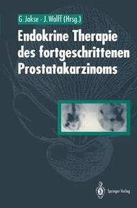 Cover Endokrine Therapie des fortgeschrittenen Prostatakarzinoms (eBook, PDF)