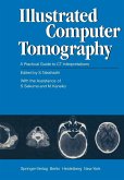 Illustrated Computer Tomography (eBook, PDF)