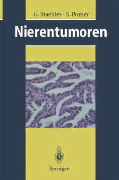 Nierentumoren (eBook, PDF) - Staehler, G.; Pomer, S.