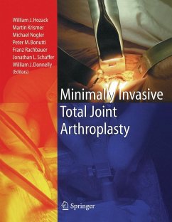 Cover Minimally Invasive Total Joint Arthroplasty (eBook, PDF)