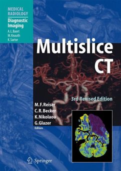 Multislice CT (eBook, PDF)