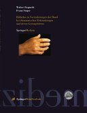 Bildatlas zu Veränderungen der Hand bei rheumatischen Erkrankungen und deren Grenzgebieten (eBook, PDF)